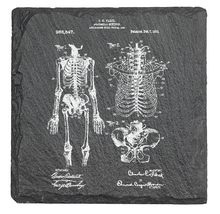 Load image into Gallery viewer, Skeleton medical - Laser engraved fine Slate Coaster